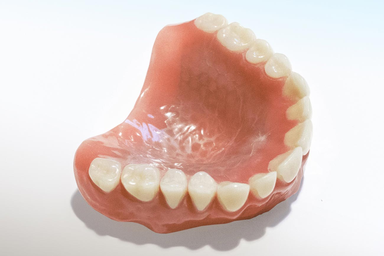 Zahnprothese ohne gaumenplatte