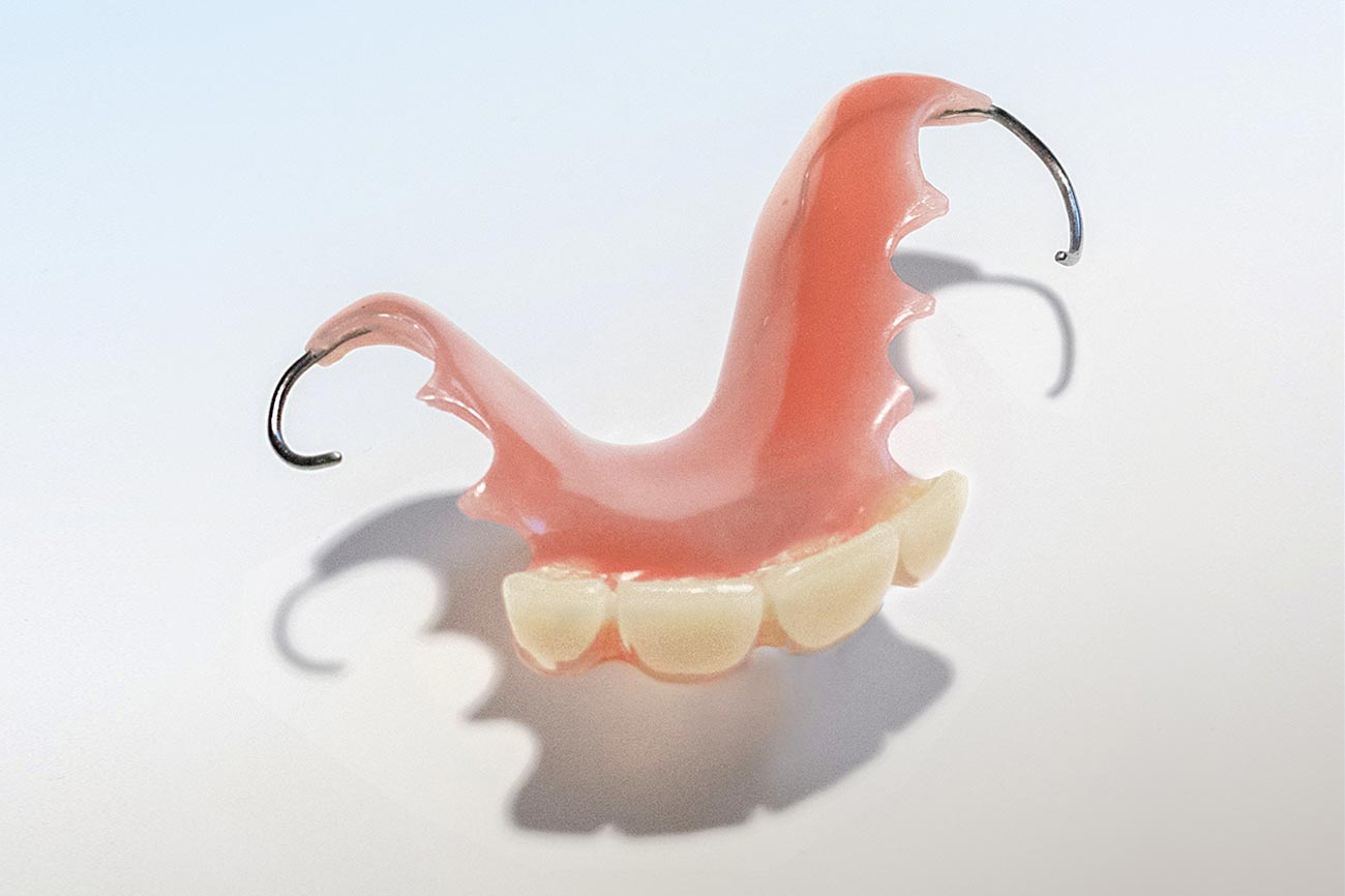 Gaumenplatte ohne zahnprothese oberkiefer Zahnprothese des