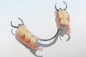 Modellguss-Zahnprothetik mit Metall-Sunflex-Kombination – Zahn Docs Diez