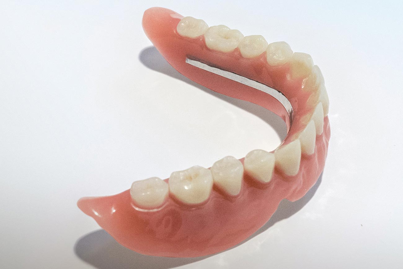 Zahnprothese ohne gaumenplatte