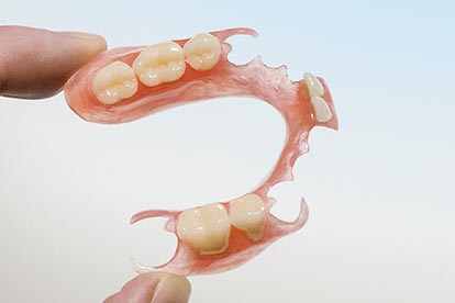 Biegsames Sunflex-Provisorium aus Kunststoff – Zahn Docs Diez