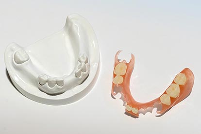 Sunflex-Provisorium mit Modell – Zahn Docs Diez